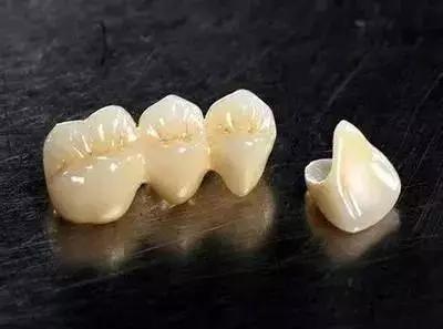 牙齿折断根部怎么弄出来,牙齿断了医生说先观察一段时间