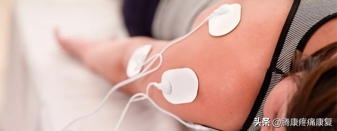 肩关节急性钙化性肌腱炎