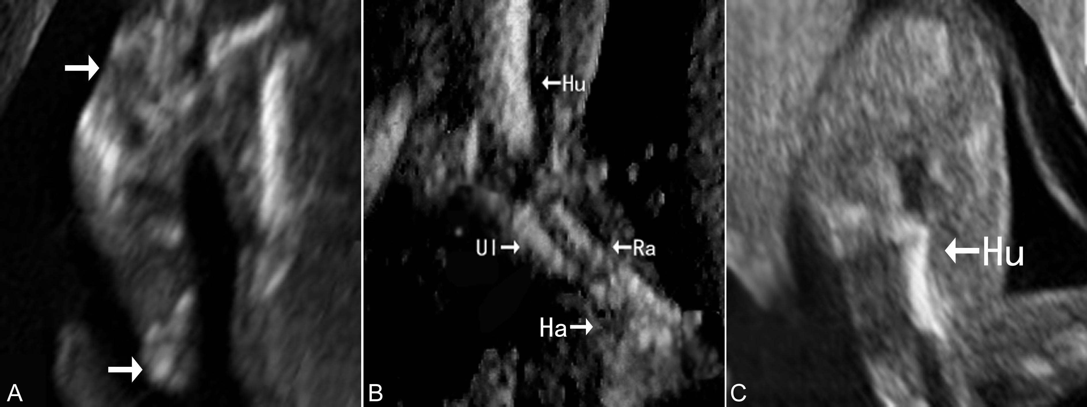 明明白白做ct检查,明明白白做超声