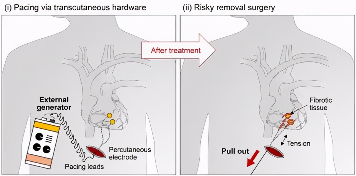 振海康健康早报「7月7日」：抗衰老领域经济效益或达数万亿美元