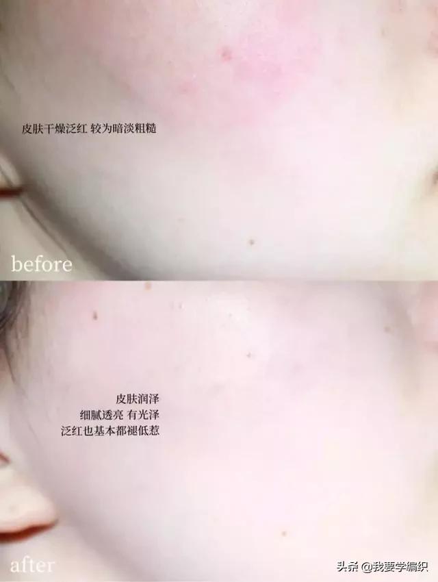 冬天脸干,连皱纹都出来了?日本女博士教你一招,抹几下白白嫩嫩