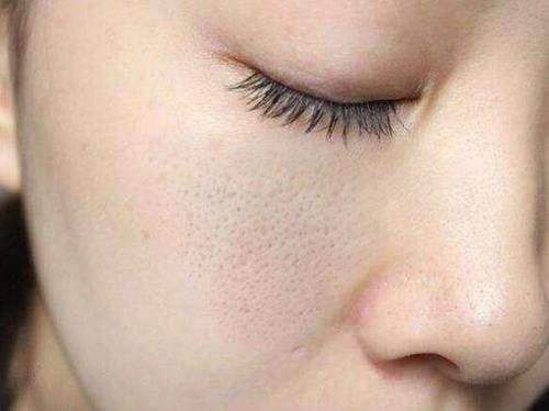 毛孔粗大怎么办教你一招根除,毛孔粗大怎么让毛孔变得细腻
