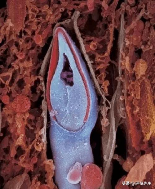 将光导管与内窥镜相机连接，向全世界展示了人类生命诞生的奥妙