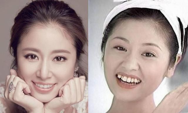 明星牙齿矫正过的图片对比,明星的牙齿怎么都是全部整的吗