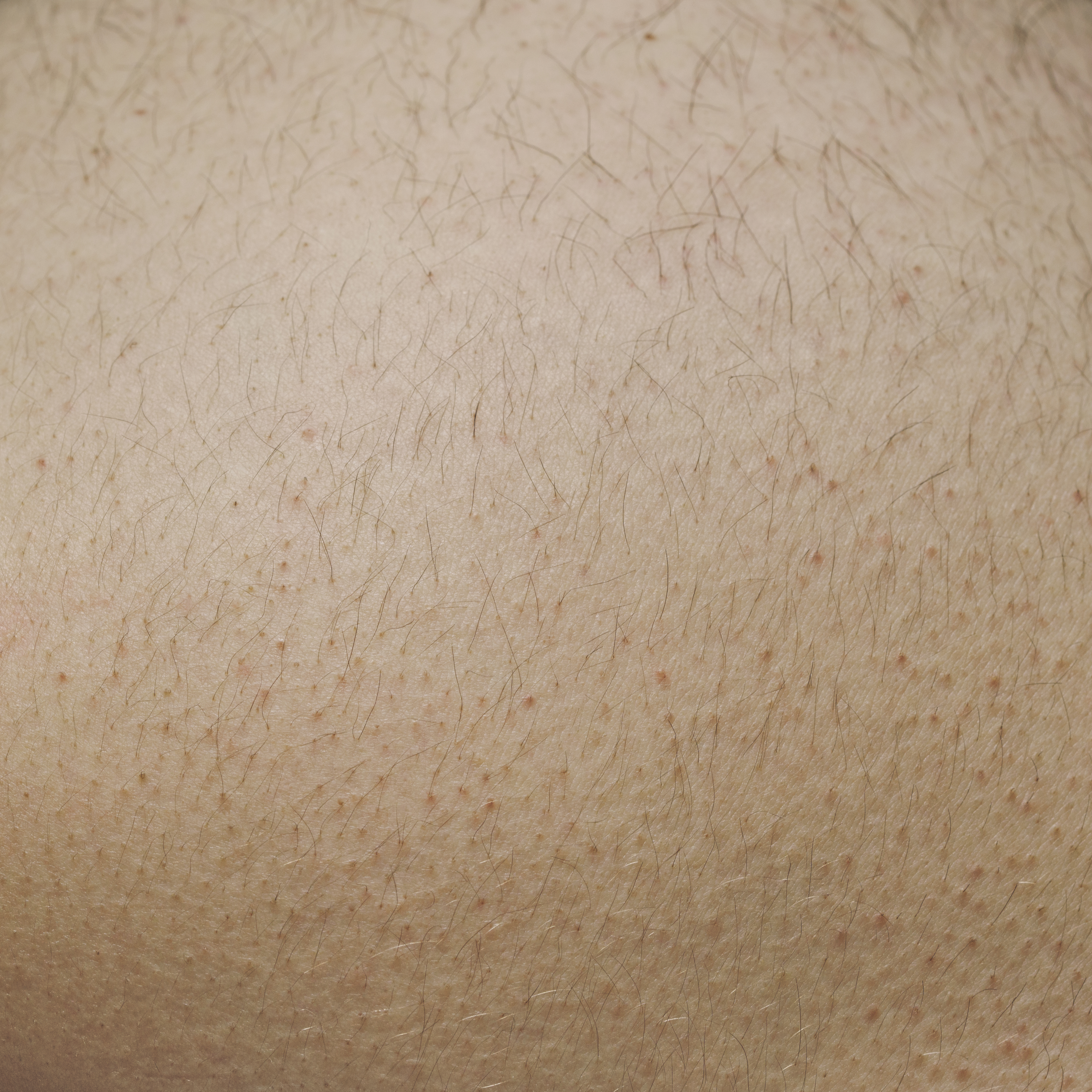 皮肤干燥起皮皲裂吃什么,一起涨姿势