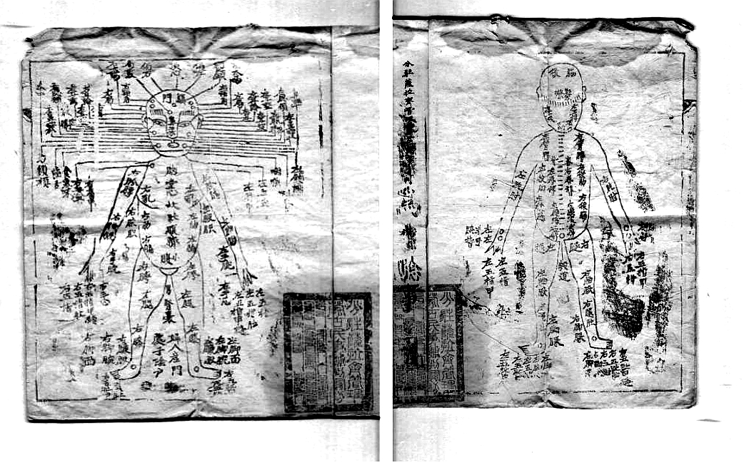 古代的验尸体,古代的验尸