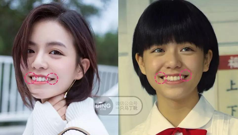 凸嘴微笑练习方法表情管理,前凸嘴怎么做表情管理