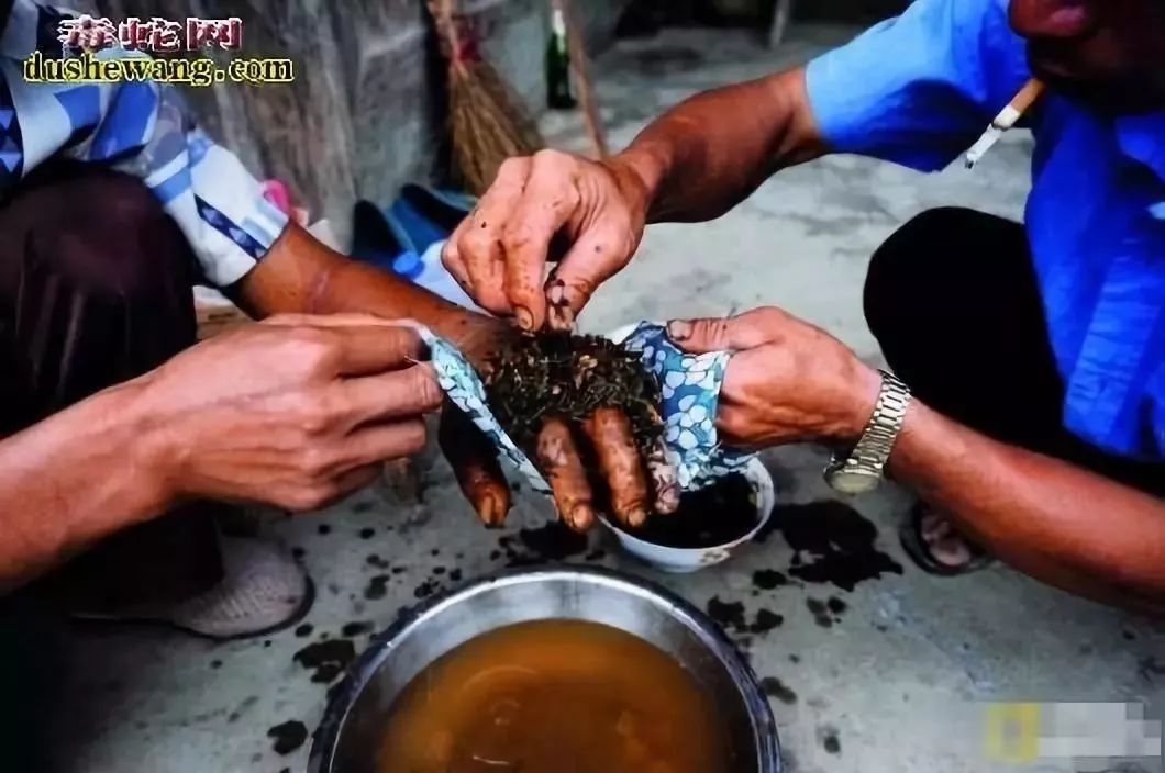 毒蛇咬伤截肢,毒蛇咬食指怎么处理