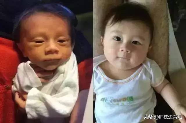 新生儿一个月后变化图,宝宝刚出生到满月的变化