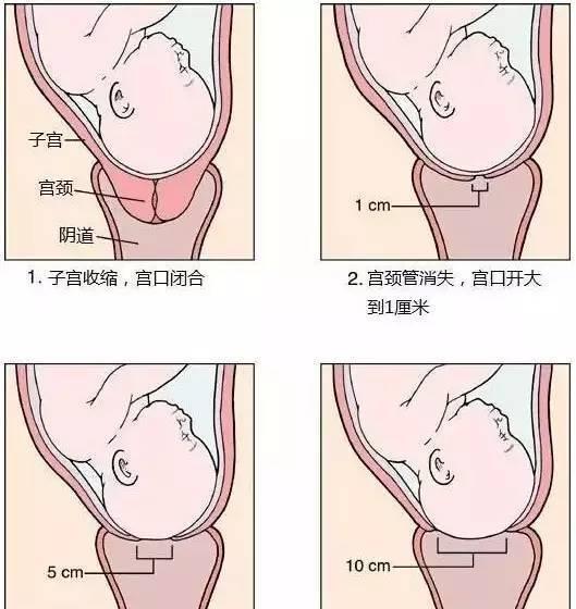 顺产全过程自述孕妈真是太伟大了