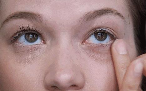 眼袋显老10岁三种方法帮助改善,眼袋显老怎么解决