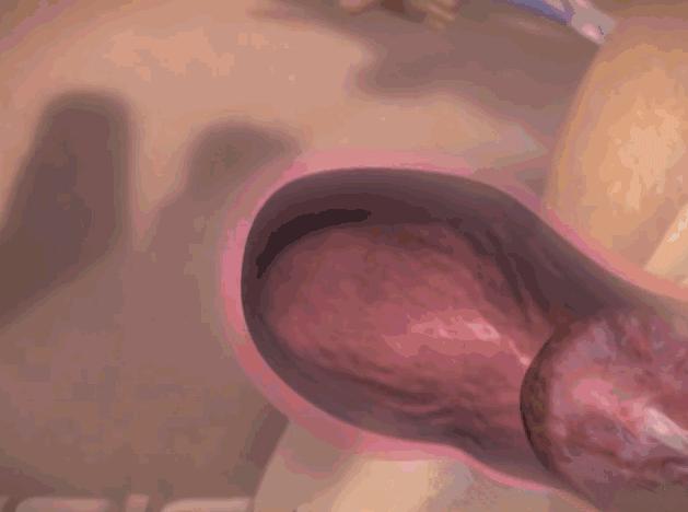 顺产生孩子剖腹产的真实流程,顺产剖腹产生孩子的真实流程