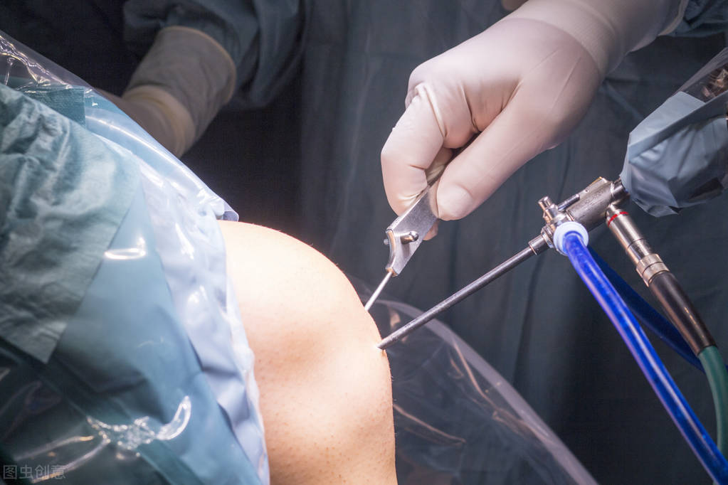 膝关节骨关节炎怎样手术能治好,膝关节镜能治好关节炎吗