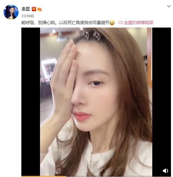 金晨鼻子透光引热议,金晨惹争议网红脸状态不佳
