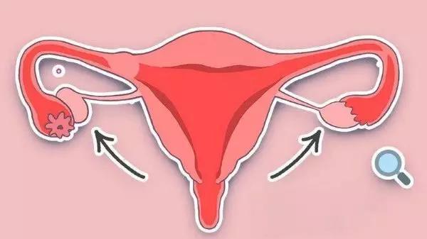 黄体破裂的症状什么时候开始腹痛,下腹痛警惕黄体破裂