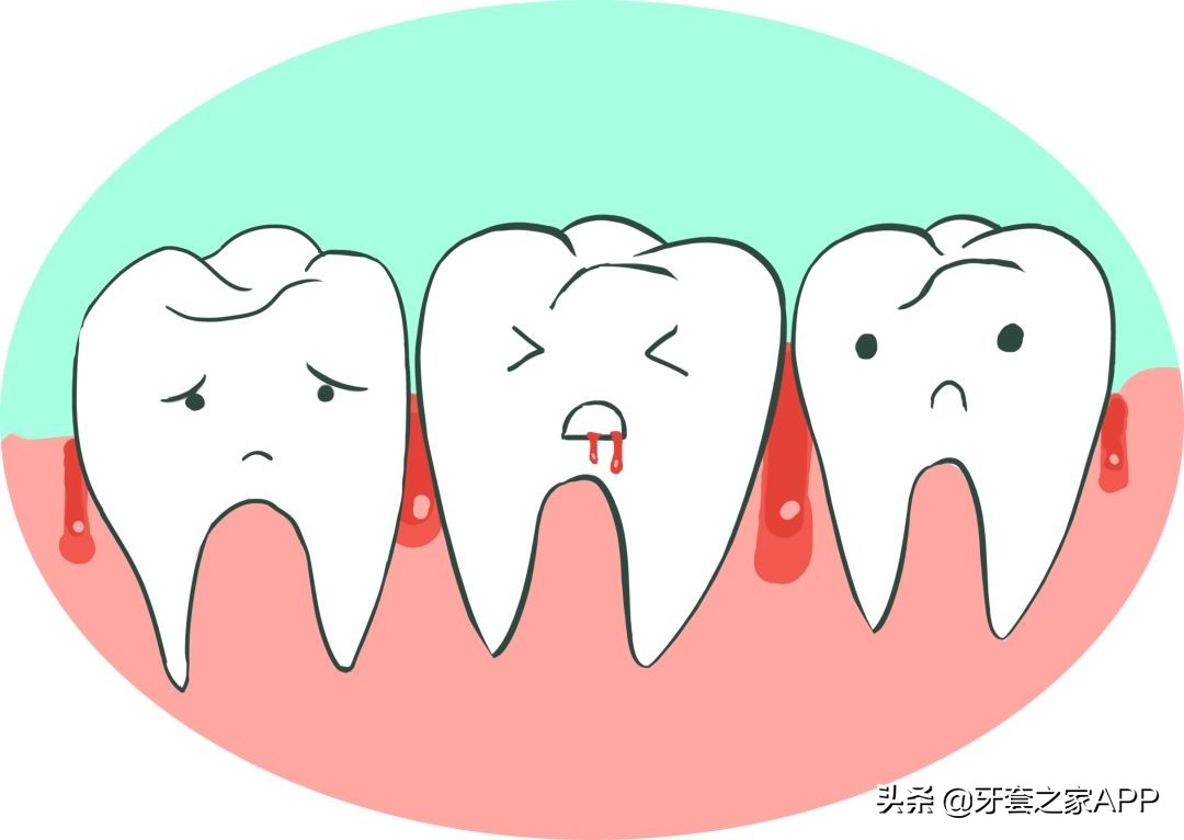 疫情时牙套遇到突发情况怎么办？应对办法在这里