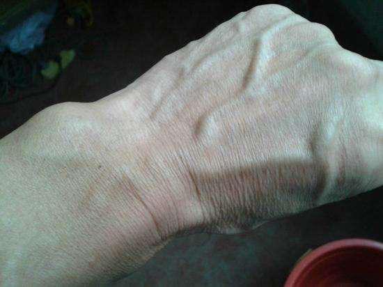 手背青筋明显是血管硬化的表现吗,血管有问题看哪个科