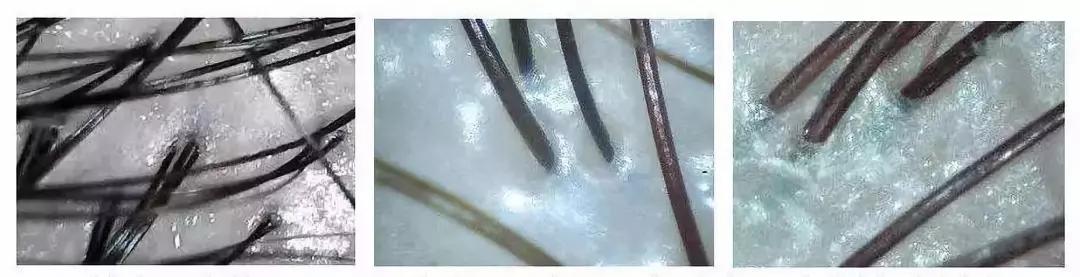 明星亲测有效的护肤品,明星亲测