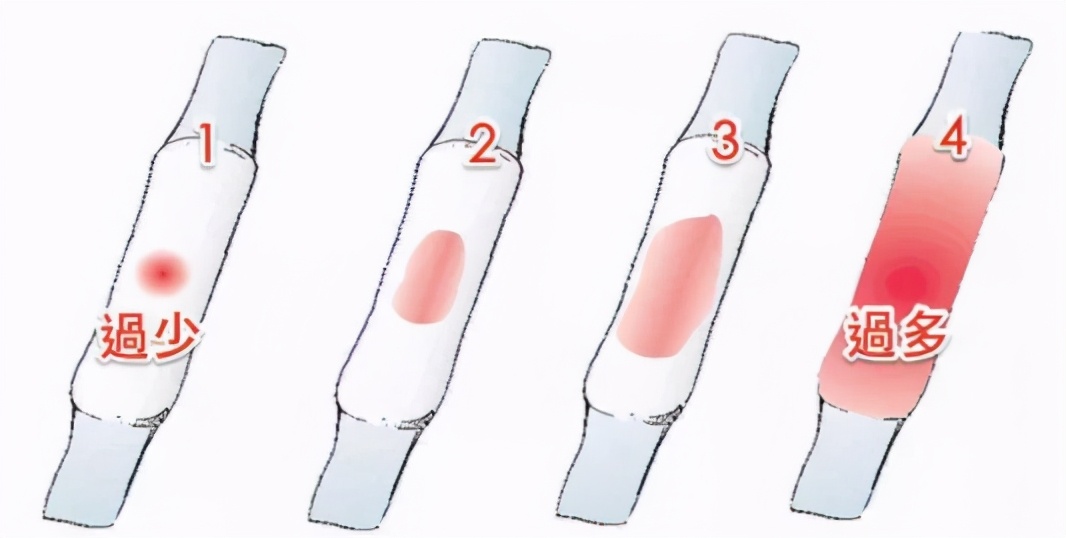 月经量大有血块中医说法,今天月经量突然太多怎么回事