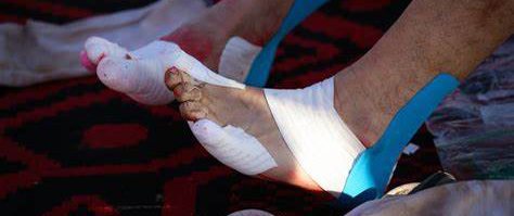 为什么跑步太久胸部会疼,为什么跑马拉松的人胸部会流血