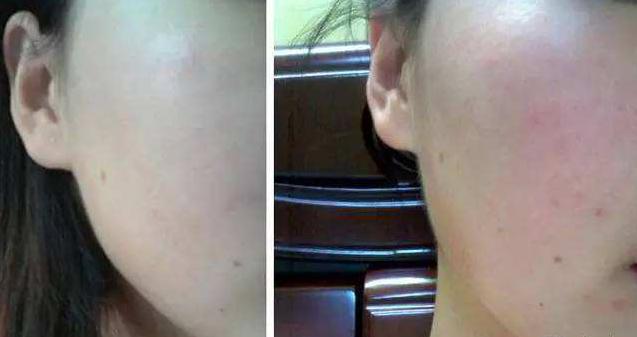 别傻了，你买的boots黄瓜系列，压根没用