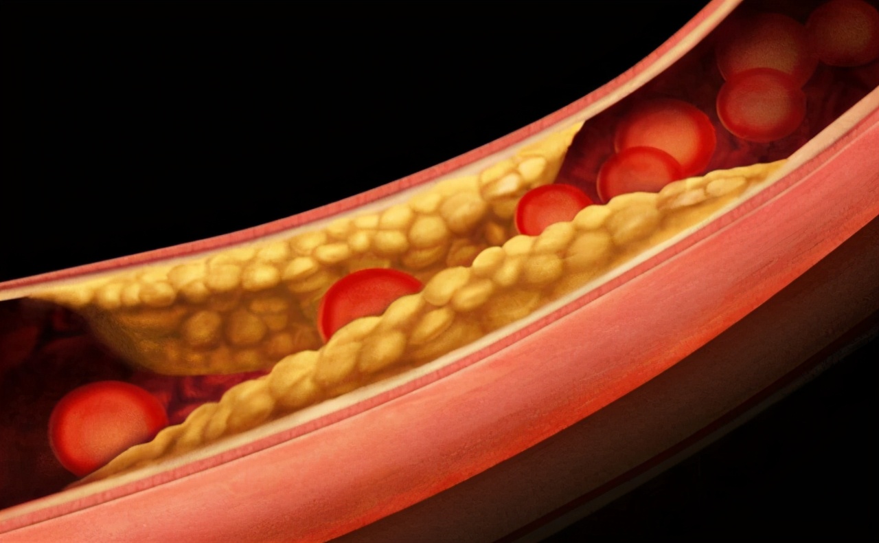 杭州一名43岁女子,每天服用一片叶酸,半年后有哪些变化?