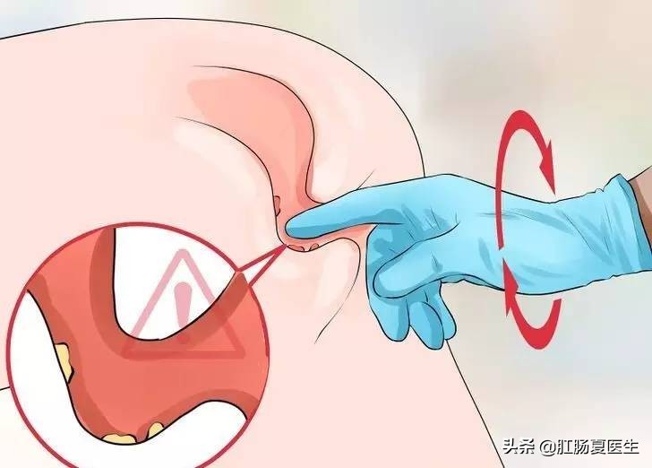 医院里让人尴尬的几项检查,医院里哪些让人尴尬的检查
