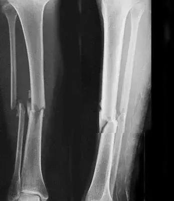 征兵体检前一天注意事项,征兵体检时有什么要注意的事项