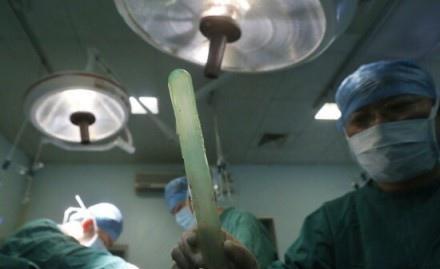 活久见！兴化男子为治便秘将黄鳝塞进直肠，黄鳝咬穿肠子进入腹腔