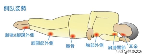世界压疮预防日,预防压疮和护理压疮