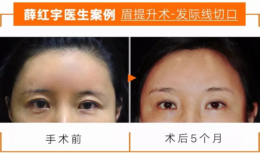 明星逃不过的年龄,明星都逃不过的衰老