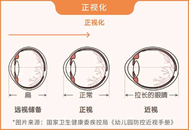 greenlife叶黄素能缓解近视吗,叶黄素矫正近视的眼贴