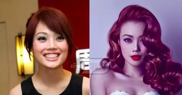 颅顶太低如何自救,颅顶低怎么自救