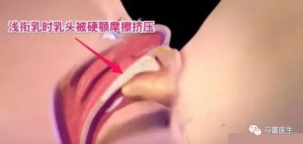 马蕾哺乳专家,马蕾医生科普视频