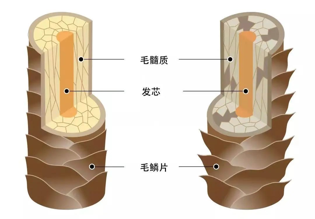 油头有头屑洗发水推荐,头屑油头用什么洗发水