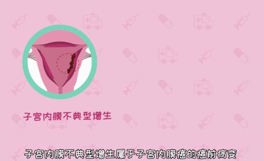 警惕6种不明显症状,警惕貌似正常的月经