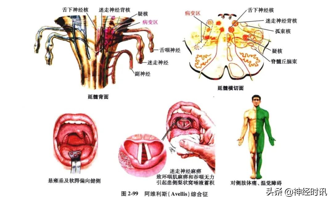 脑干解剖,脑干神经解剖