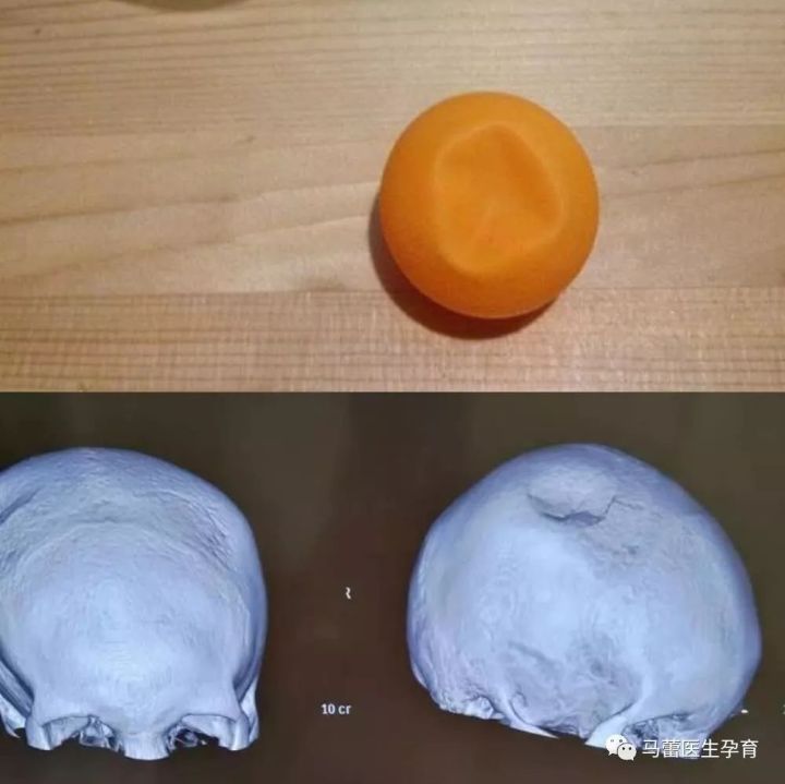 孩子撞头了出现哪几种症状,孩子头部被撞多久判断没事