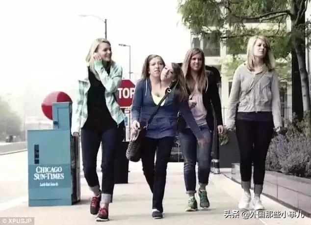 罕见双头连体人能活多久,诡异的双头生物