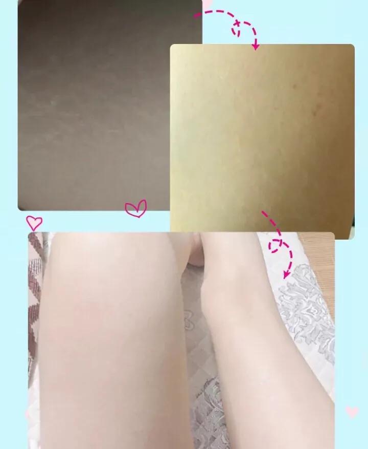 为什么坐久屁股会黑,为什么坐久了屁股臭