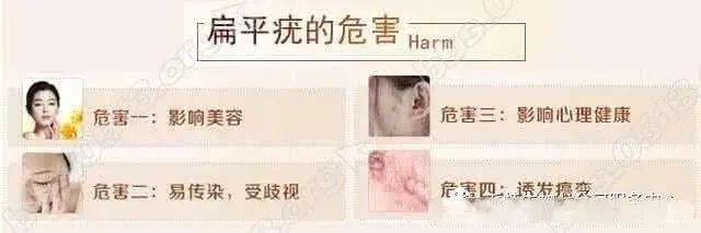 6岁儿童丝状疣怎么治疗,小孩子得寻常疣是什么原因造成的