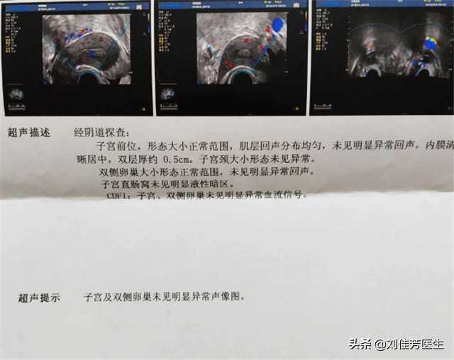 输卵管炎症有办法痊愈吗,50岁输卵管积液不治疗有什么危害