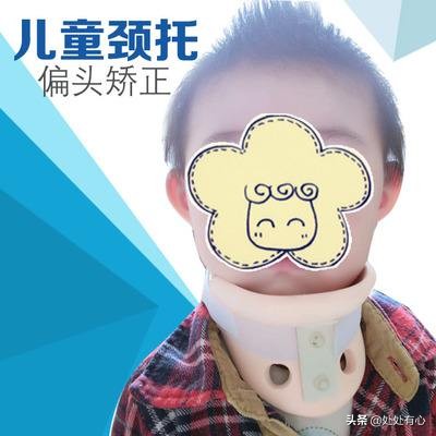 偏头疼的危害有哪些,长时间偏头有什么危害