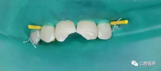 口腔科普咨询,口腔医院挂号预约流程