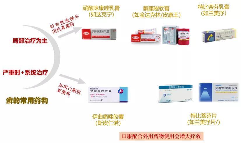 体癣和湿疹有什么区别,手癣和湿疹合并怎么治