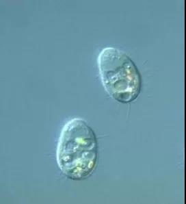 污泥镜检操作方法,污泥检测项目及标准有哪些呢