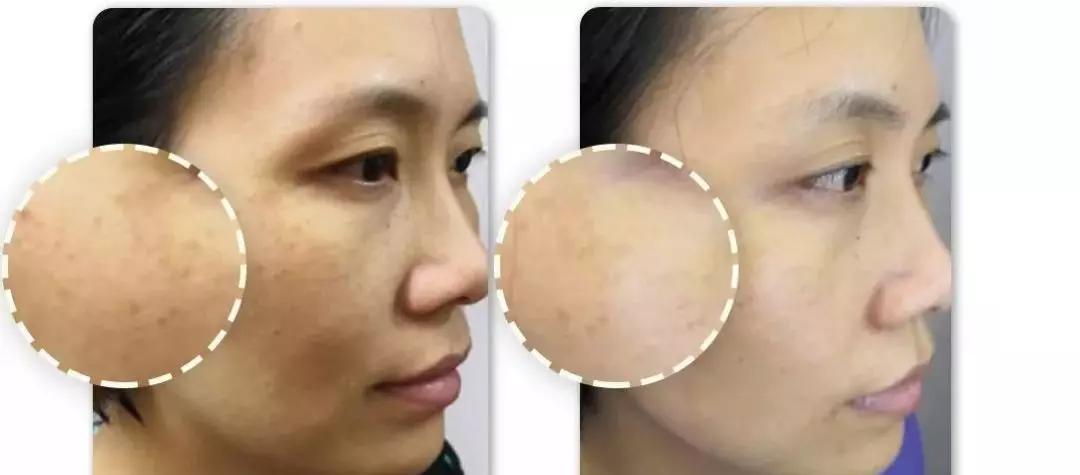 真人改造|不靠医美，一天实现“换皮”