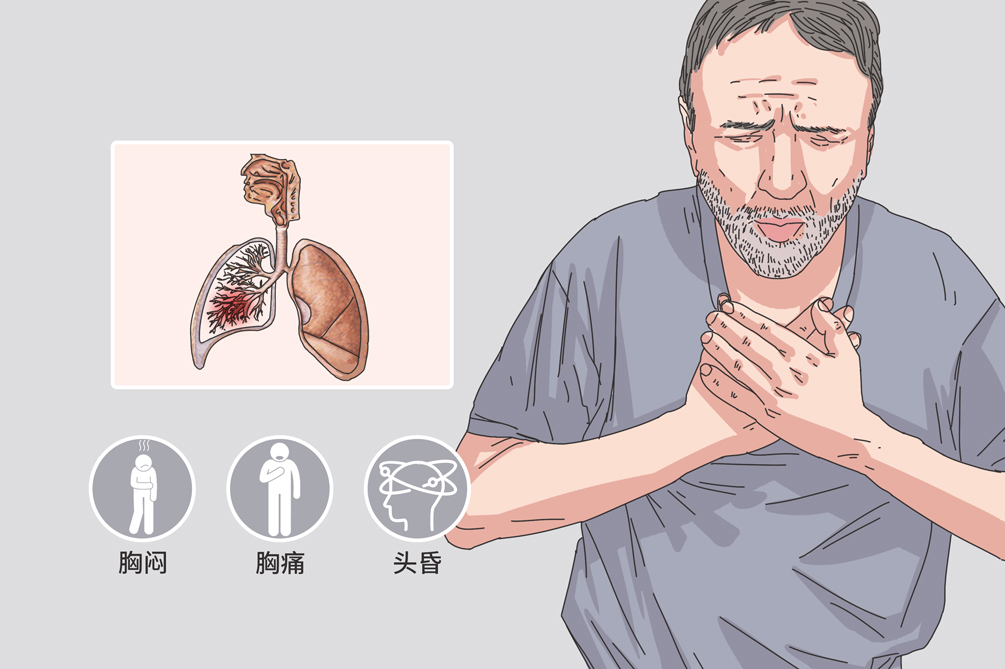 尿素循环障碍什么症状,尿素循环障碍能治好吗