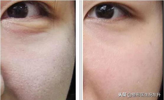 90%的皮肤问题都是缺水导致的,每天8杯水补水