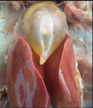 安卡拉病心包积液图片,心脏出血引起的心包积液